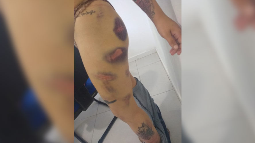 Homem é preso após torturar e obrigar ex-namorada a comer&nbsp;fezes