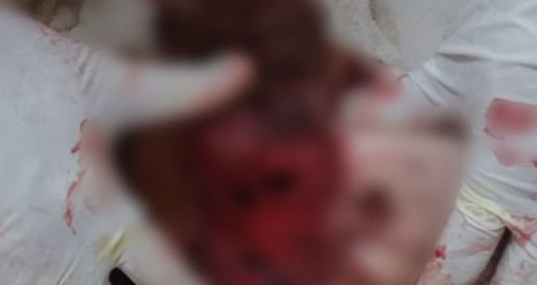 Comissão em Defesa dos Animais da OAB acompanha caso de agressões a uma&nbsp;cadela