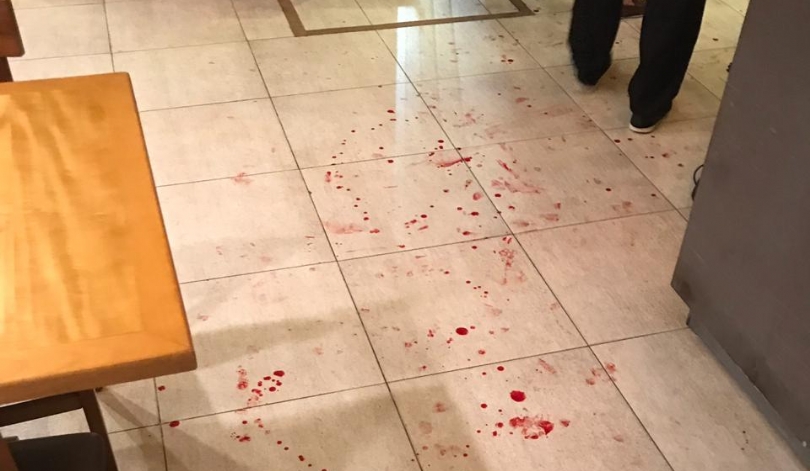 Mulher é agredida por companheiro em pizzaria de São&nbsp;Luís
