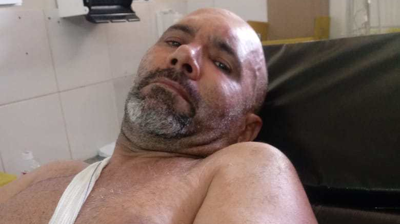 Motorista é baleado e tem caçamba&nbsp;roubada