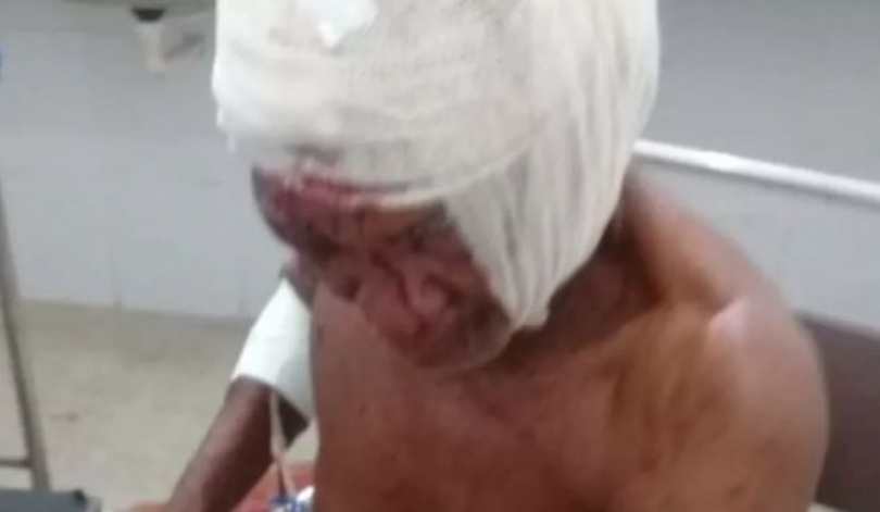 Adolescente é apreendido após esfaquear e espancar idoso em Santo&nbsp;Amaro
