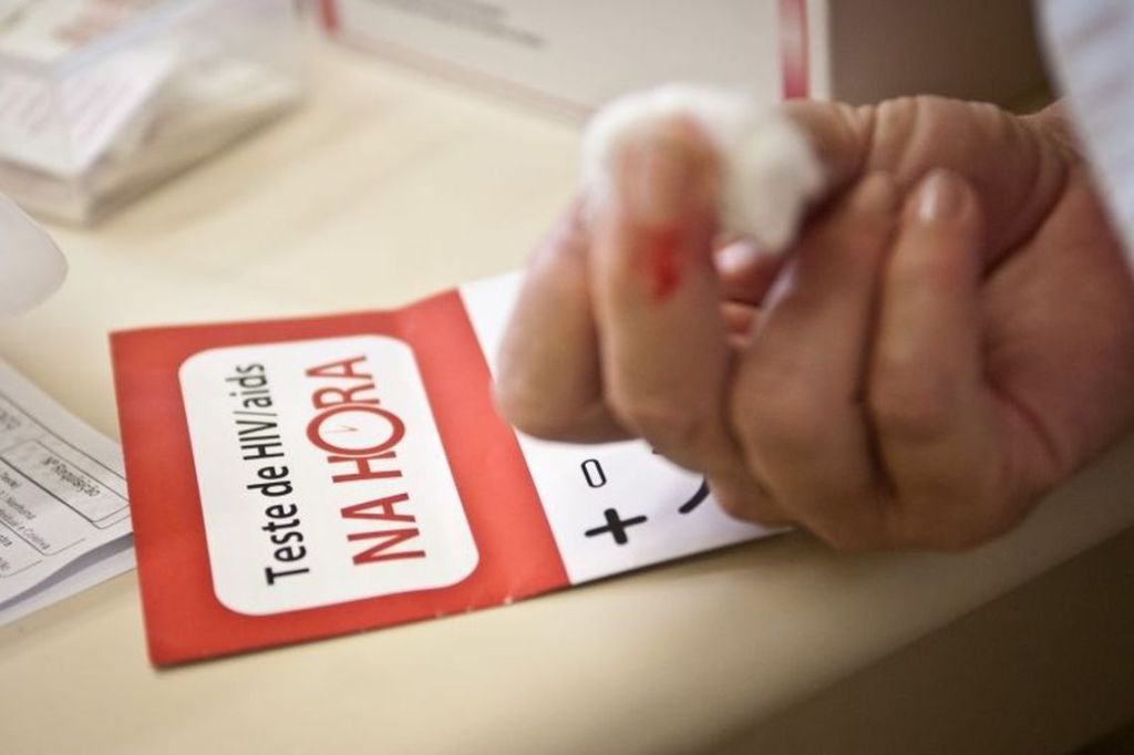 Ministério da Saúde: 135 mil convivem com HIV no país sem&nbsp;saber