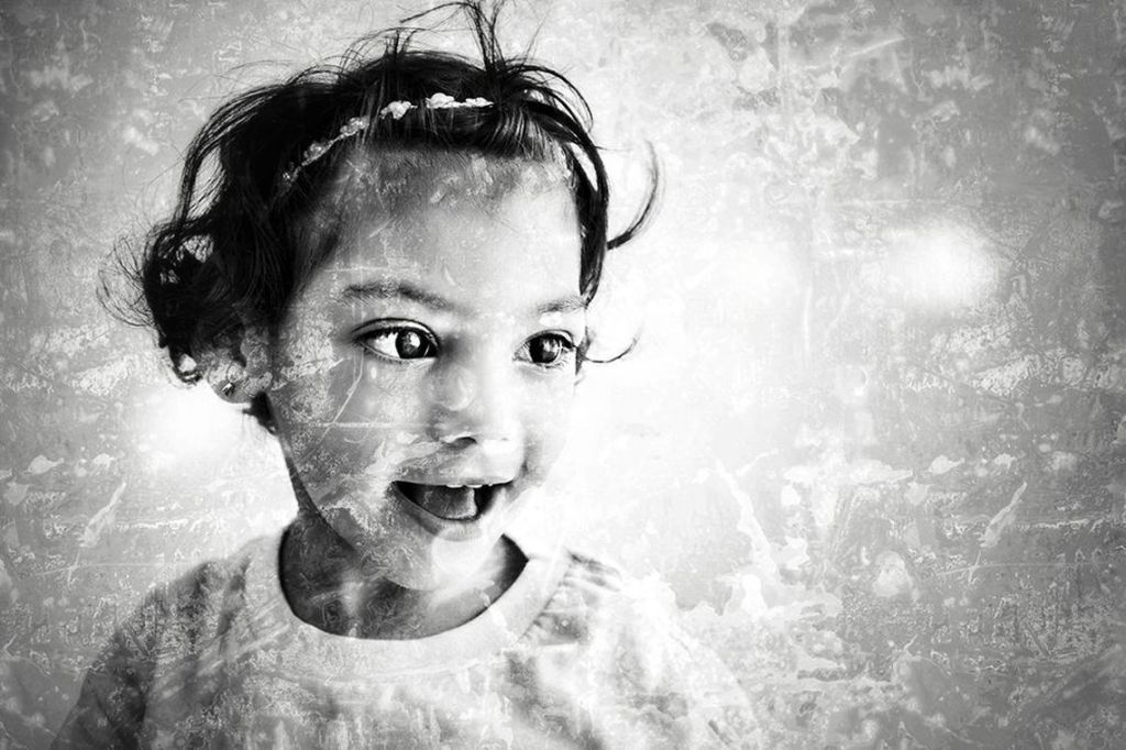 Exposição de fotos mostra crianças afetadas pelo vírus&nbsp;Zika