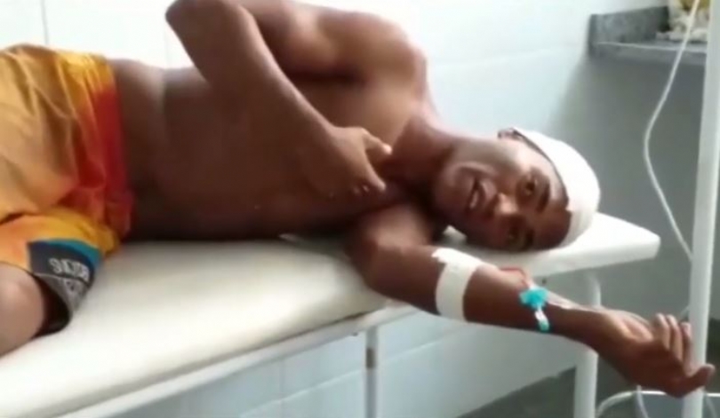 Homem baleado na cabeça chega andando em hospital de Codó
