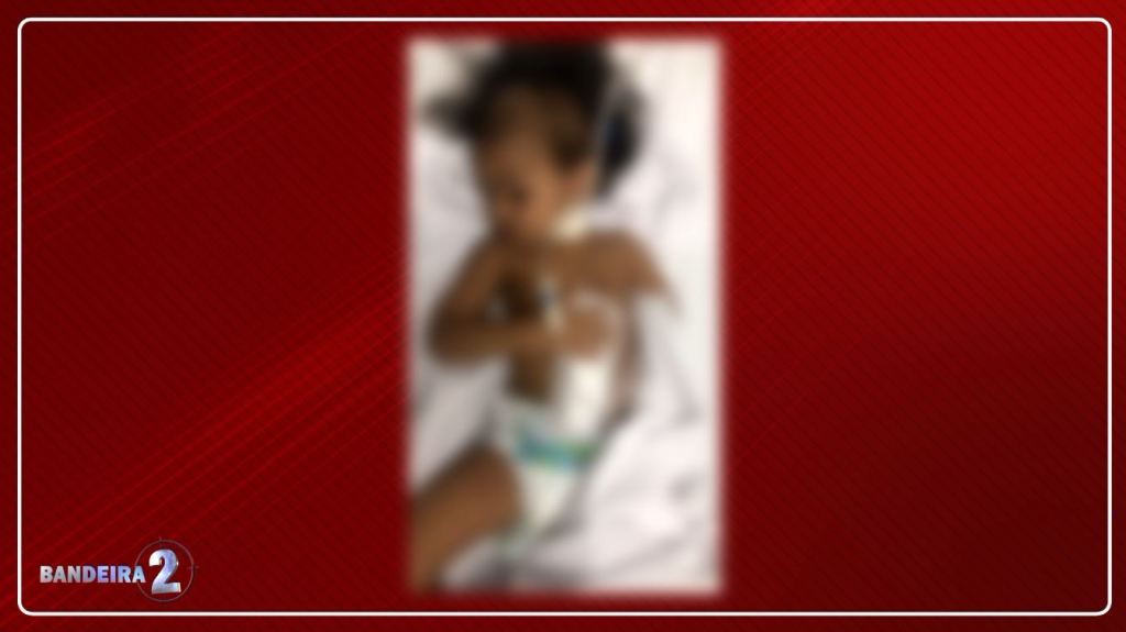 Criança de 2 anos perde o baço após sofrer agressão da própria&nbsp;mãe