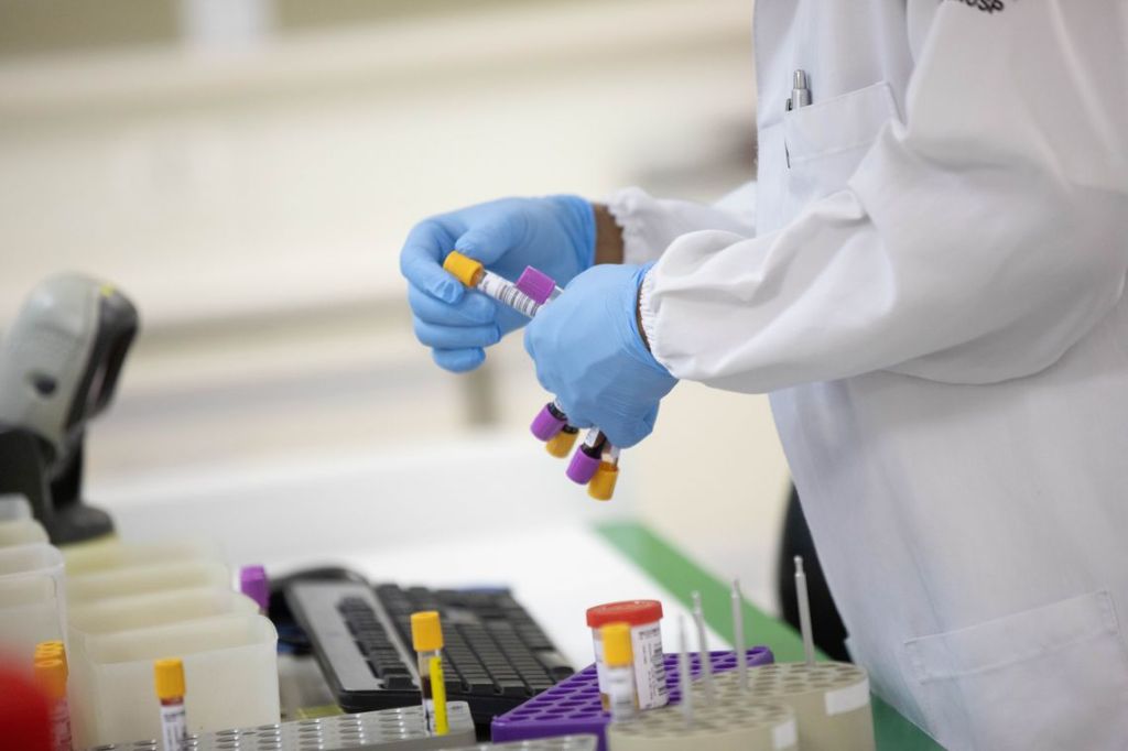 Sobe para 22 o número de casos confirmados de H1N1 no&nbsp;Maranhão.