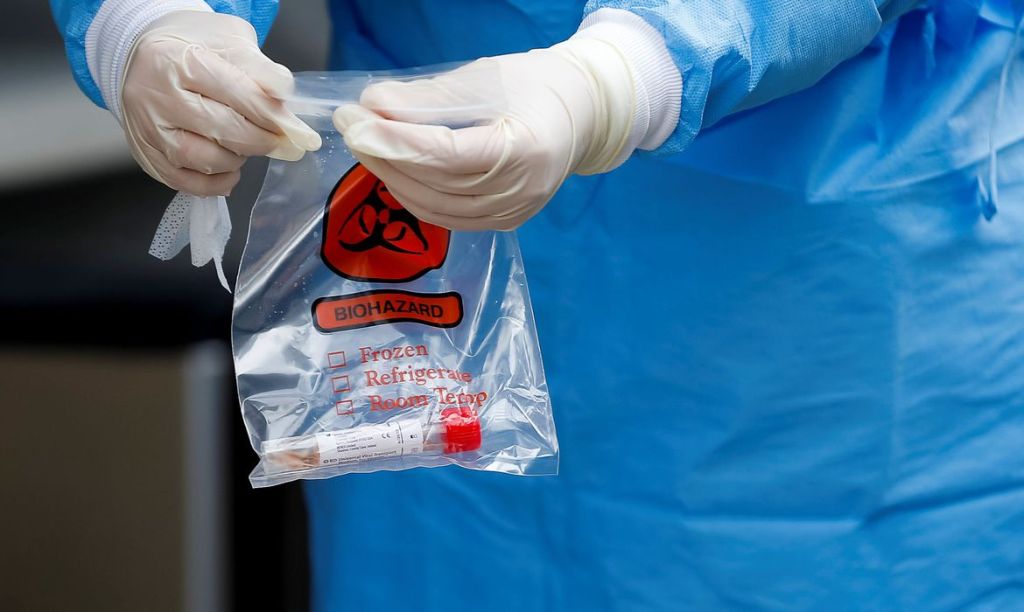 Covid-19: 500 mil kits de teste rápido chegam ao&nbsp;Brasil