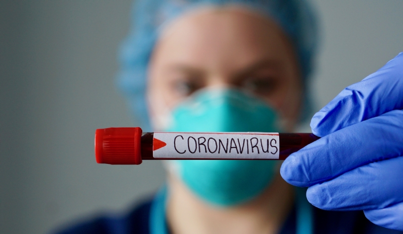 Sobe para 71 o número de casos de Covid-19 no&nbsp;Maranhão.