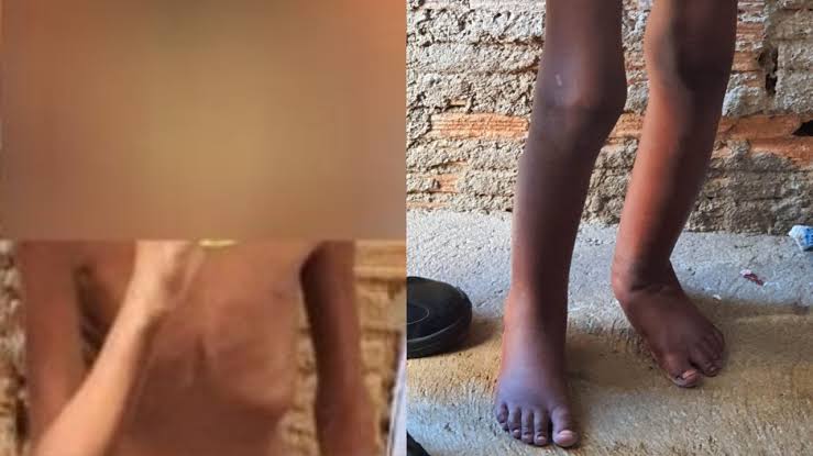 Vídeo: PMs libertam criança que era mantida acorrentada dentro de&nbsp;tambor