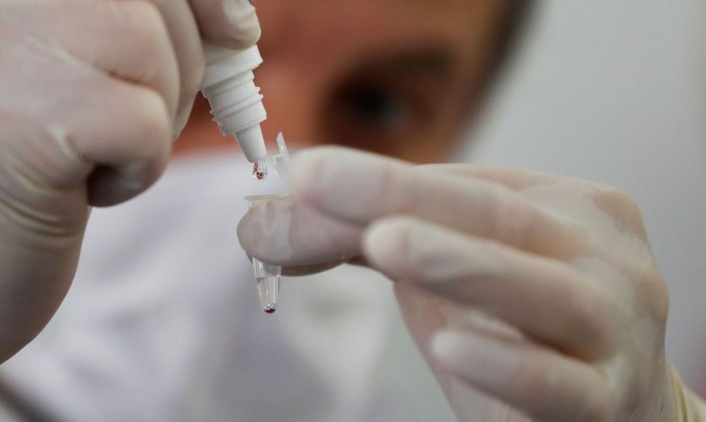 Mais de 100 mil testes de Covid-19 foram realizados no&nbsp;Maranhão