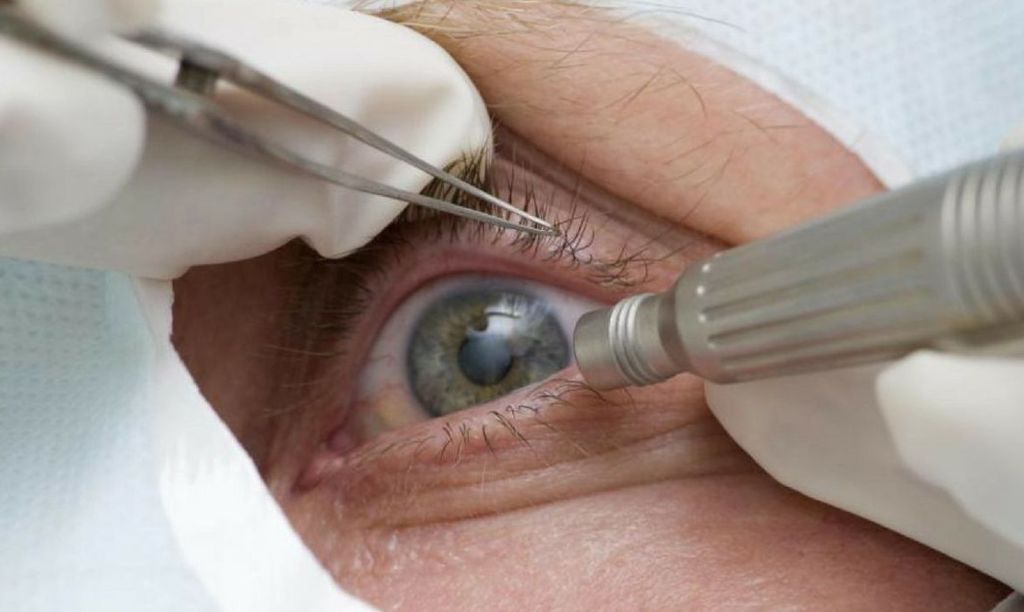 Pandemia faz cair detecção precoce de&nbsp;glaucoma