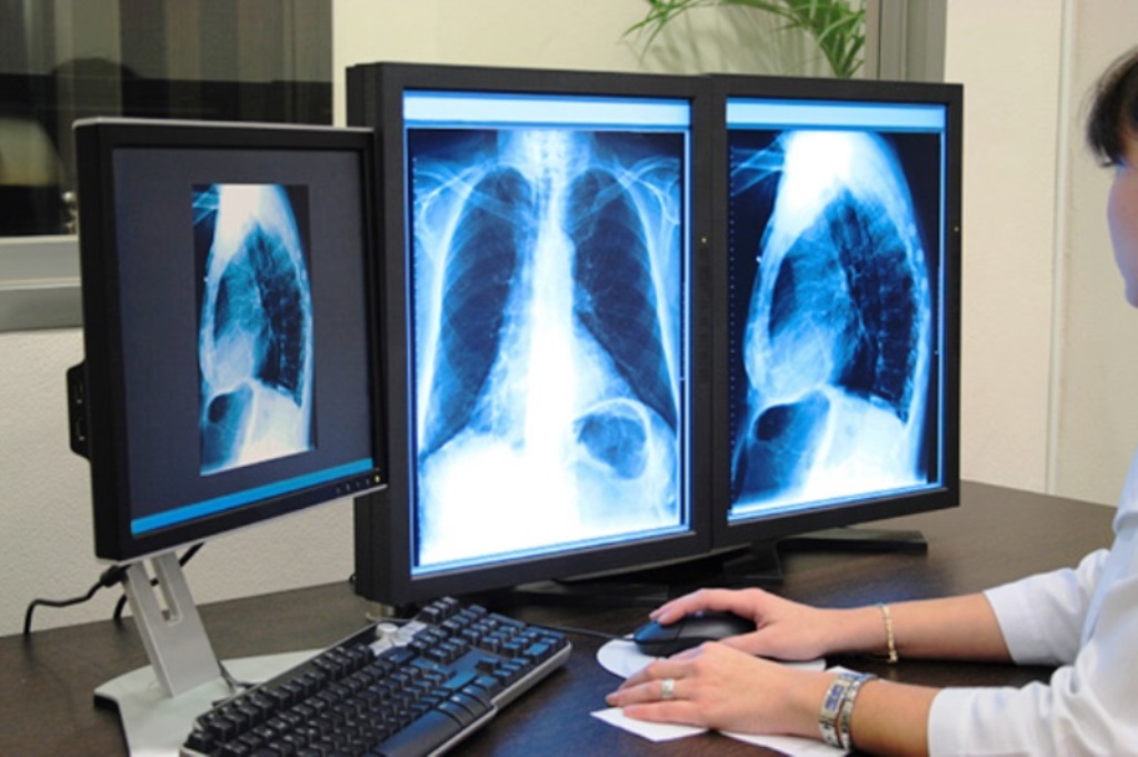 iMedical Presidente Dutra faz diagnóstico por exames de imagem em atletas&nbsp;lesionados
