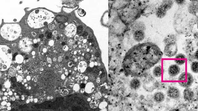 Imagem da variante ômicron é capturada pela 1ª vez por&nbsp;cientistas
