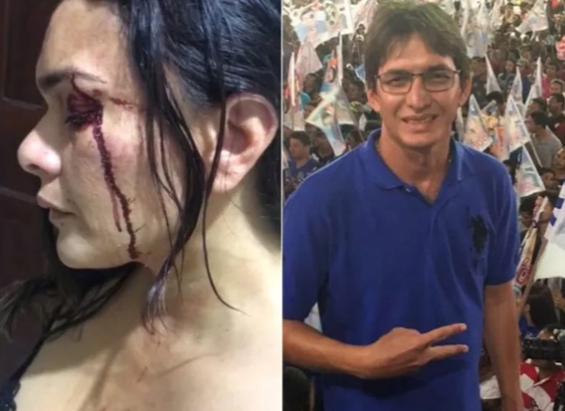 Ex-candidato a prefeito de Matinha é investigado por suspeita agressão a ex-mulher: “Não aceitou a separação”