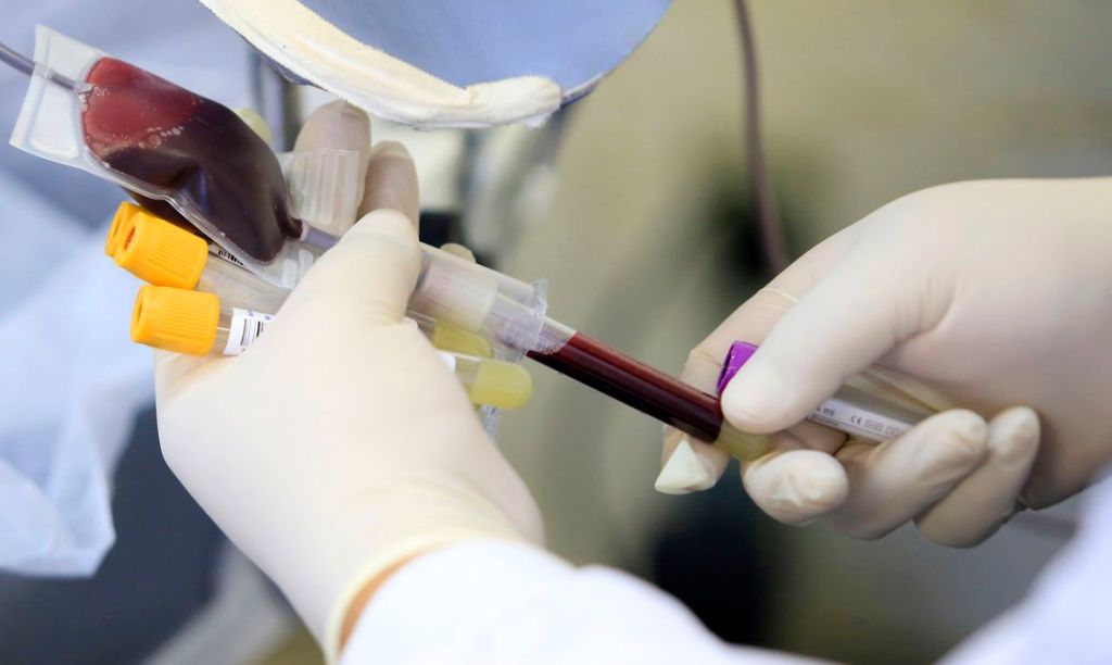 Varíola dos macacos: Anvisa faz recomendações sobre doação de&nbsp;sangue