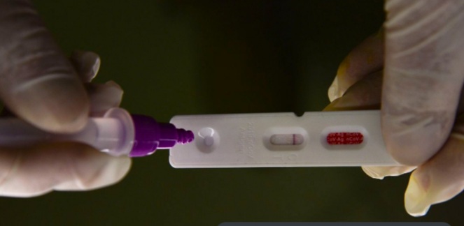 Pesquisadores identificam método capaz de prever gravidade da&nbsp;covid-19