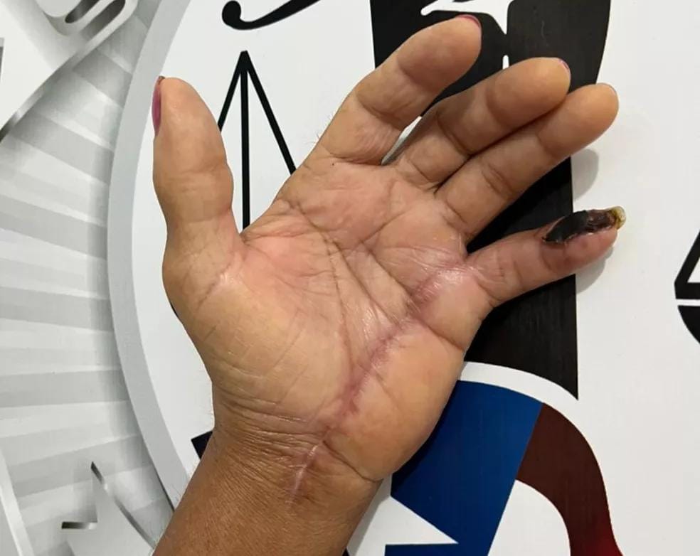 Homem é preso suspeito de desferir golpes de facão em idosa durante briga em Paço do&nbsp;Lumiar