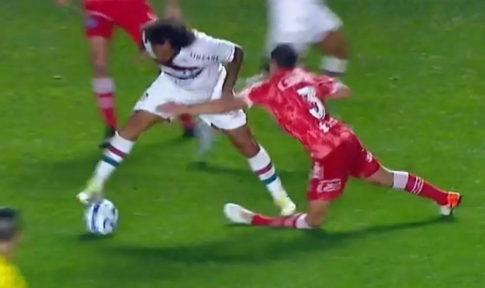 Imagens fortes: portal divulga fotos de como teria ficado o joelho de jogador atingido por&nbsp;Marcelo