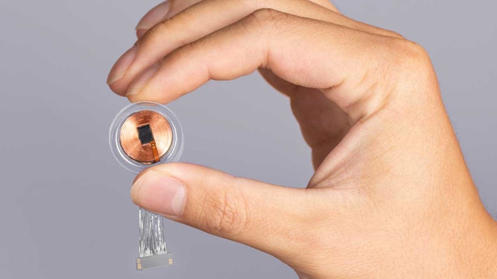 Humano recebe primeiro implante de chip cerebral de empresa de Elon&nbsp;Musk