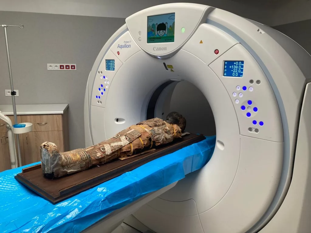 Objeto misterioso encontrado em múmia de criança egípcia