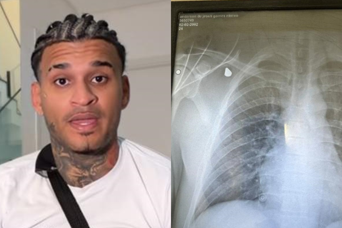 Anderson Neiff atualiza estado de saúde após ser baleado em São Paulo
